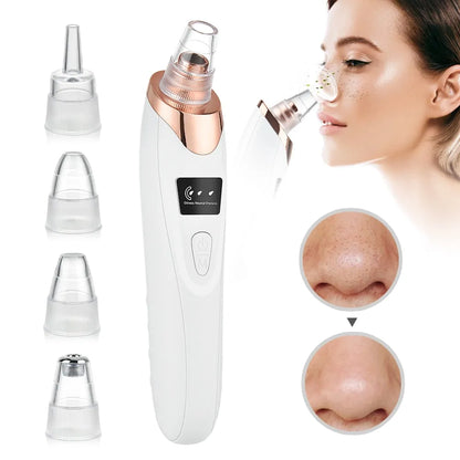 Blackhead Remover Vacuum